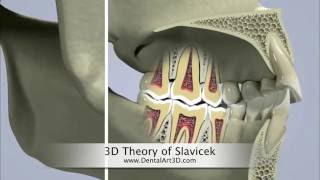 DentalArt3D 3D Theory of Slavicek [upl. by Coffin]