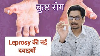 Leprosy की नई दवाइयाँ  कुष्ट रोग  New Medicine for Hansens Disease leprosy hansen Treatment [upl. by Quartana]