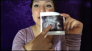 My First Ultrasound 5weeks 2daysNo Yolk Sac Yet [upl. by Bunny]