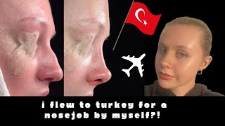 I flew ALONE to Turkey for a closed rhinoplasty NOSE JOB hospital tests recovery amp cast removal [upl. by Shepley463]