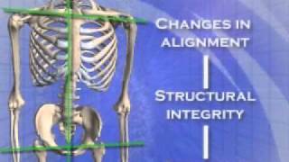 About the Atlas Orthogonal procedure [upl. by Pardner]