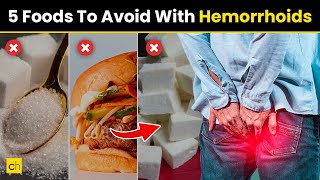 5 Foods To Avoid With HemorrhoidsPILES  Credihealth hemorroida piles [upl. by Oregolac222]