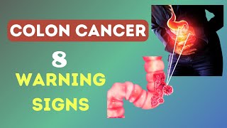 Are You at Risk Learn the 8 Signs of Colon or Rectal Cancer [upl. by Sclar]