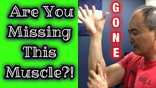 Missing Muscle Palmaris Longus Test  Dr Wil amp Dr K [upl. by Luemas]