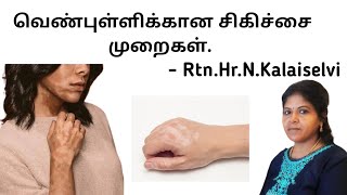 Vitiligo home remedies in tamil  skin disease  தமிழ்  RtnHrNKalaiselvi [upl. by Budge]