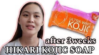 NAKAKAPUTI NGA BA AFTER 3WEEKS REVIEW HIKARI ULTRA WHITE KOJIC SOAP [upl. by Harat783]