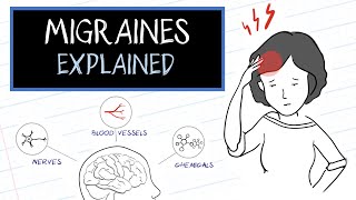 What are Migraines HealthSketch [upl. by Rombert]