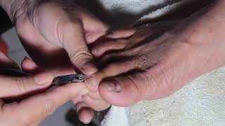 How to Clean Toenails for Grandmothers Living in Rural Areas [upl. by Garret629]