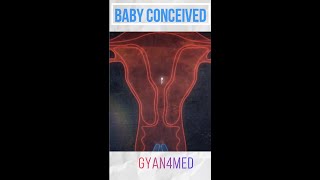 Fertilization How is a baby conceived [upl. by Ahsyas309]