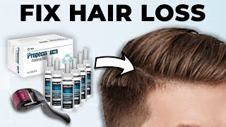 Men How To Fix Hair Loss At Home Full Guide [upl. by Davide671]