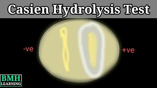 Casein Hydrolysis Test  Skim Milk Agar  Casien Proteinase Test  Milk Agar Test [upl. by Llenram]