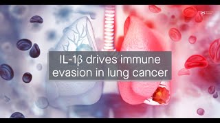 IL1β upregulates immune checkpoint regulators to promote immune evasion in lung adenocarcinoma [upl. by Adnilak3]