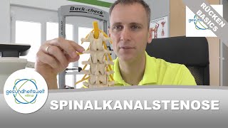 Spinalkanalstenose  Enge im Spinalkanal [upl. by Kopple990]