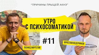 Утро с Психосоматикой Прыщи Акнэ  Ведерников Вячеслав [upl. by Nosydam]