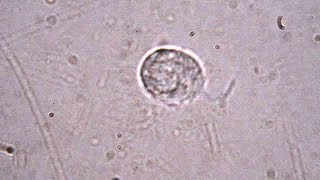 Trichomonas vaginalis  sexually transmitted parasite [upl. by Joanne749]