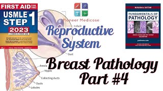 Breast pathologyCancer from Pathoma in urdu Part4 Reproductive system pathUrduHindi [upl. by Notsej]