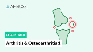 Arthritis amp Osteoarthritis  Part 1 Joint Structure [upl. by Peppel863]