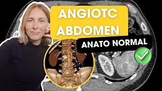 AngioTC de abdomen Anatomía normal y secretos para la mejor evaluación✅ [upl. by Tatianna]