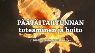 Päätäitartunnan toteaminen ja hoito [upl. by Perdita]