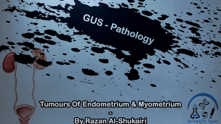 Tomours Of Endometrium amp Myometrium [upl. by Bosson]