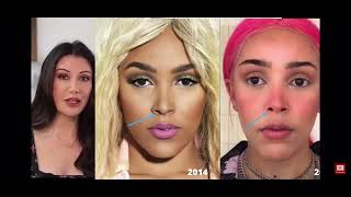 Lorry Hill  Doja Cat Plastic Surgery Analysis REUPLOADED [upl. by Town978]