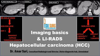 Cases in Radiology Episode 1 neuroradiology CT MRI [upl. by Eleaffar648]