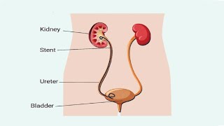 Anatomy urogenetal module  kidney and ureter  الكلية و الحالب [upl. by Atiral]