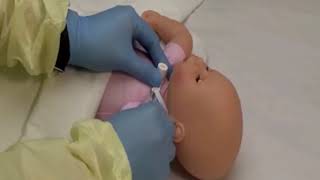 Tracheostomy Tube Change [upl. by Wernher51]