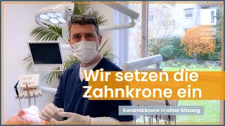 Zahnkrone einsetzen Ablauf Krone in einer Sitzung mit CEREC  Carree Dental Köln [upl. by Amer477]