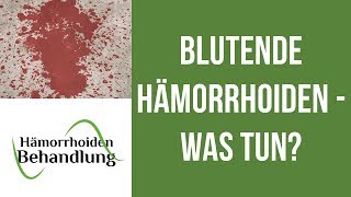 Blutende Hämorrhoiden  Was kann man tun wenn die Hämorrhoiden bluten [upl. by Mandle]