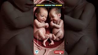 Inside mothers womb ❤️ A Small Glimpse at your Babys growth shortsfeed baby Love [upl. by Ihn]