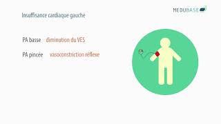 Insuffisance cardiaque  Medubasecom [upl. by Ebanreb]