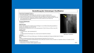 Bestrahlung vom heterotoper Ossifikation  Strahlentherapie Prof Hilke Vorwerk [upl. by Therron]