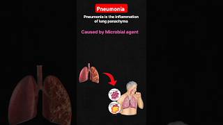 What is the pneumonia  Pneumonia etiology symptoms disease Lungsdisease [upl. by Leugimsiul]