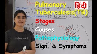 Pulmonary Tuberculosis in Hindi  Stages  Causes  Pathophysiology  Sign amp Symptoms [upl. by Matuag]