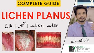 Lichen planus  Hindi  Patient teaching programme [upl. by Standing]