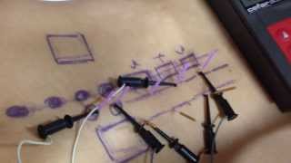 Dry Needling for Low Back Pain  Dry Needling Courses for Dry Needling Certification [upl. by Anelat]