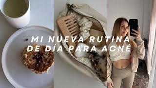 VLOG Mi nueva rutina facial para acné hormonal después de 9 años sin él [upl. by Aneg]