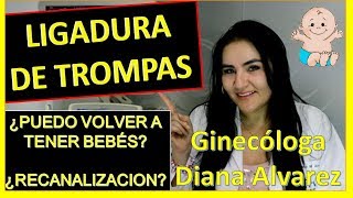 LIGADURA DE TROMPAS ¿PUEDO VOLVER A EMBARAZARME POR GINECOLOGA DIANA ALVAREZ [upl. by Calypso113]