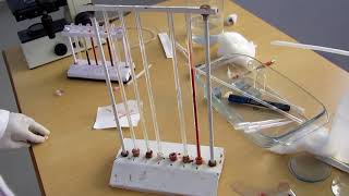 Erythrocyte sedimentation rate [upl. by Thorley]