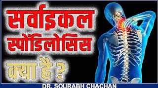 सर्वाइकल स्पोंडिलोसिस क्या है   Cervical Spondylosis  Dr Sourabh Chachan [upl. by Howarth]