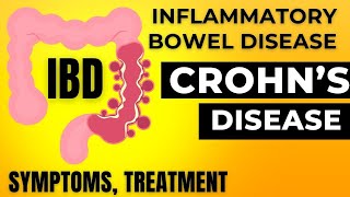 Ulcerative colitis symptoms  ulcerative colitis cause  Ulcerative colitis Treatment  In Hindi [upl. by Lemahs665]