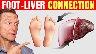 How to Use Your Feet to Diagnose Liver Problems—Dr Berg Explains [upl. by Inalial]