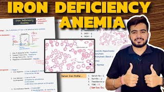 Iron Deficiency Anemia  Hematology  Pathology [upl. by Okime]