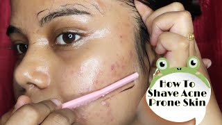 How To Shave Acne Prone Skin For Girls  Painless Facial Hair Removal At Home  Myths❌  Shree [upl. by Grindlay]