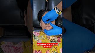 Chiropractic treatment for nasal septum deviation drrajneeshkant worldfamouschiropractor [upl. by Ahsii]