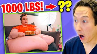 Plastic Surgeon Reacts to MY 600 LB LIFE She went from 1000 lbs to [upl. by Anam]