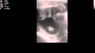 Ultrasound of a 26 day equine pregnancy [upl. by Sears220]