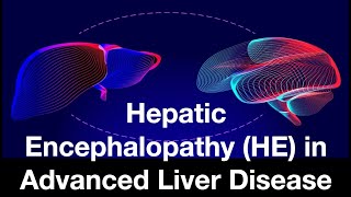 Hepatic Encephalopathy HE in Advanced Liver Disease [upl. by Lai186]