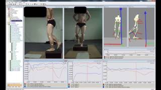 Biomechanical Screening of lower body in 3D with Simi [upl. by Idoux]